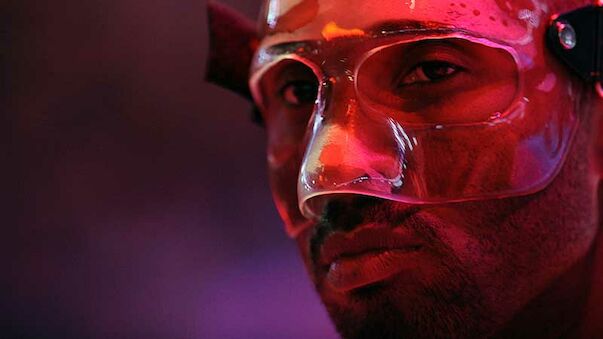 Kobe geigt mit Maske, Nowitzki verletzt