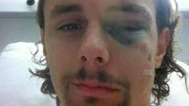 Subotic nach OP als
