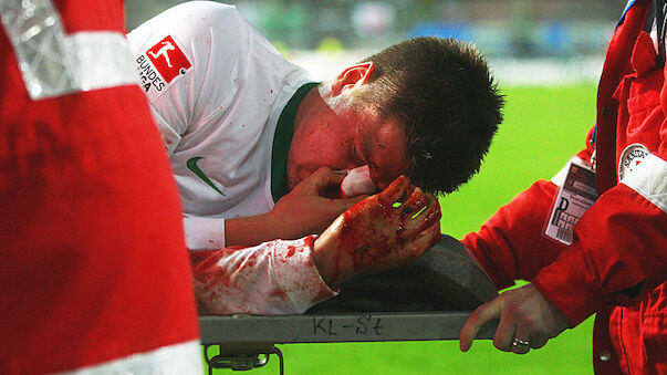 Schwere Gesichtverletzungen bei Sebastian Prödl
