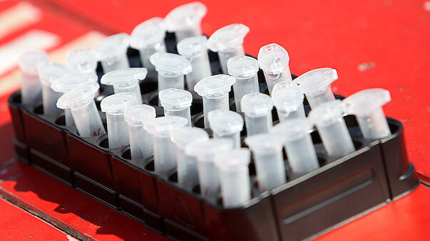 Blutpass führt zu Doping-Sperre