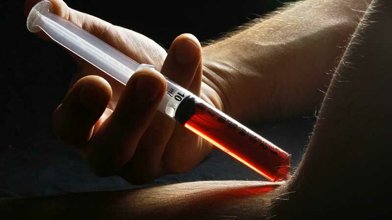 Die skurrilsten Doping-Ausreden