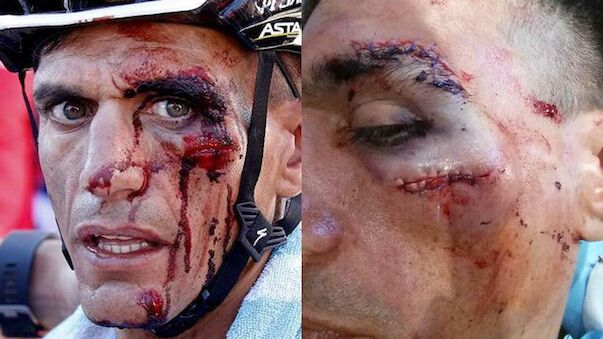 Schwere Verletzungen bei Vuelta