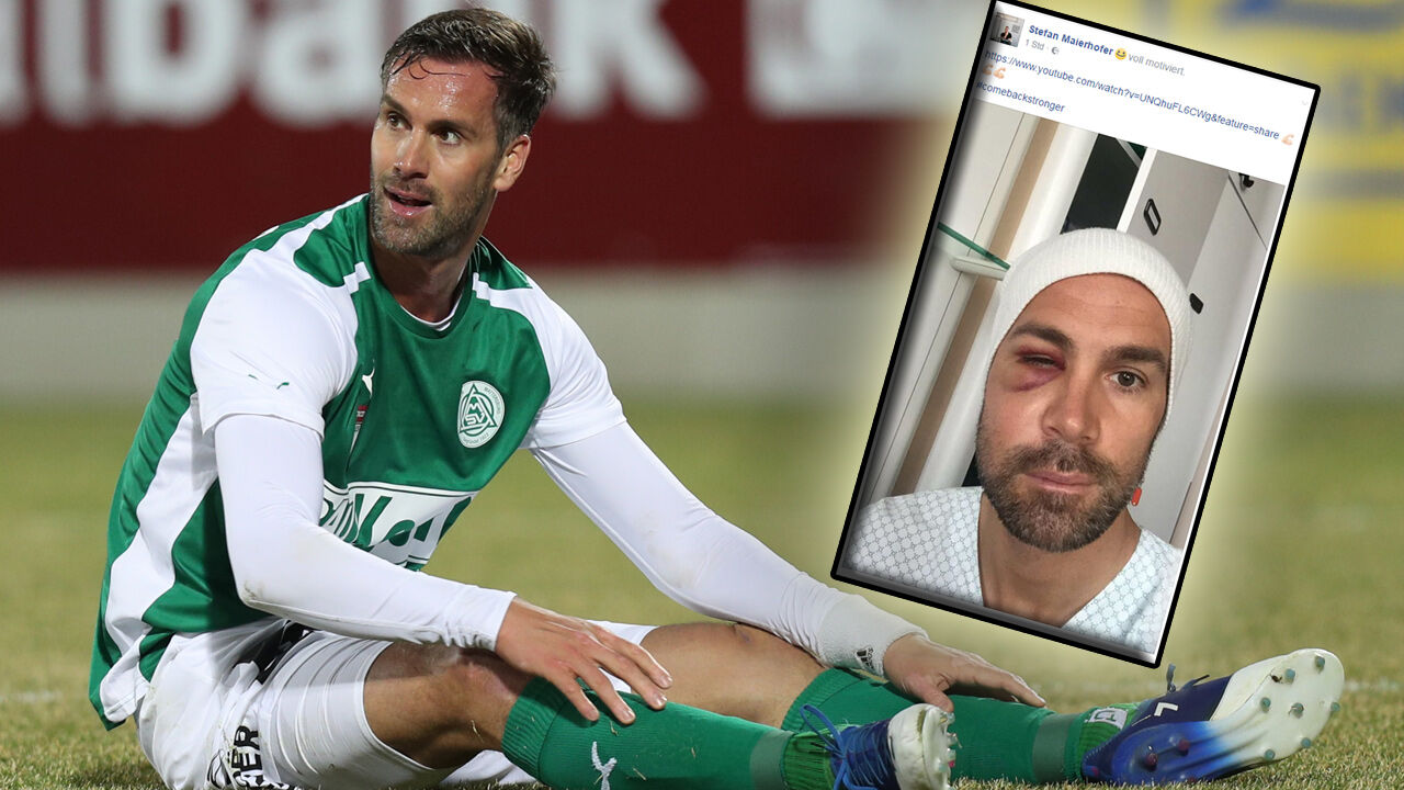 Mattersburger Stefan Maierhofer Schockt Nach Op Mit Foto Laola1 At