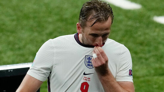 EURO 2020 LIVE: England - Tschechien, Gruppe D - Fussball ...
