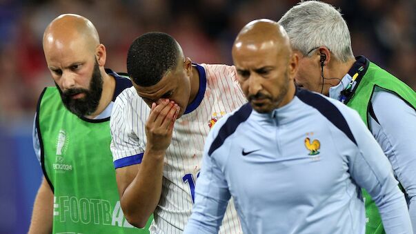 Wegen Bruch: Nasen-OP für Frankreich-Star Mbappe