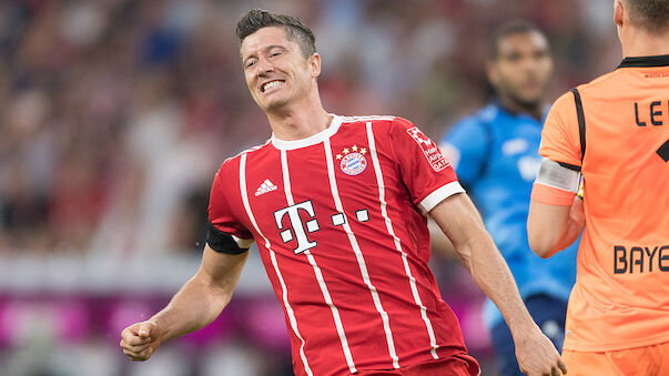 Robert Lewandowski kritisiert den FC Bayern