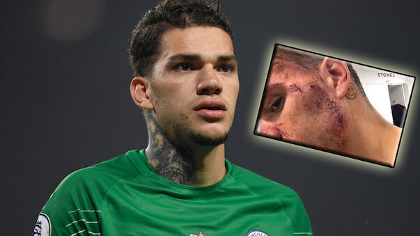 Ederson nach Manes Kung-Fu-Tritt gezeichnet