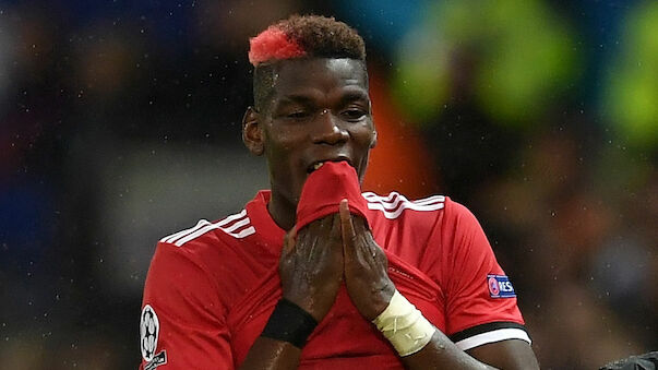 Pogba fällt für längere Zeit aus