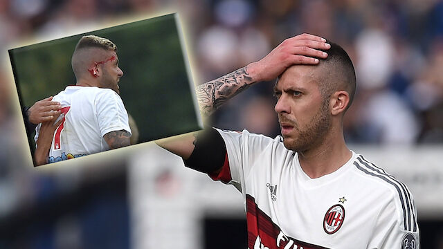 Menez verliert Teil seines Ohrs