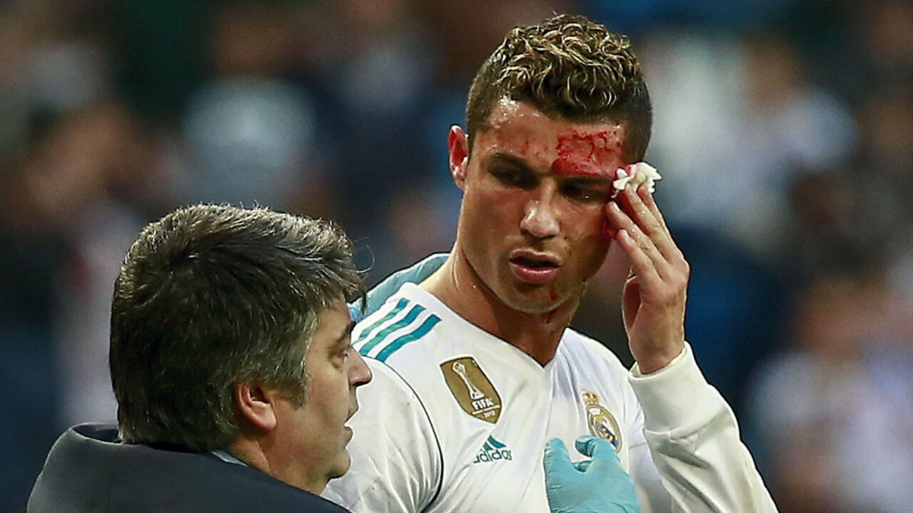 Cristiano Ronaldo: Blut-"Selfie" amüsiert das Web ...