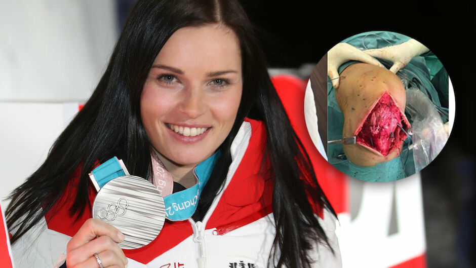Anna Veith Zeigt Krasses Op Foto Wintersport Ski Alpin