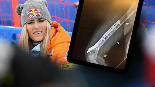 Lindsey Vonn bricht sich den Oberarm