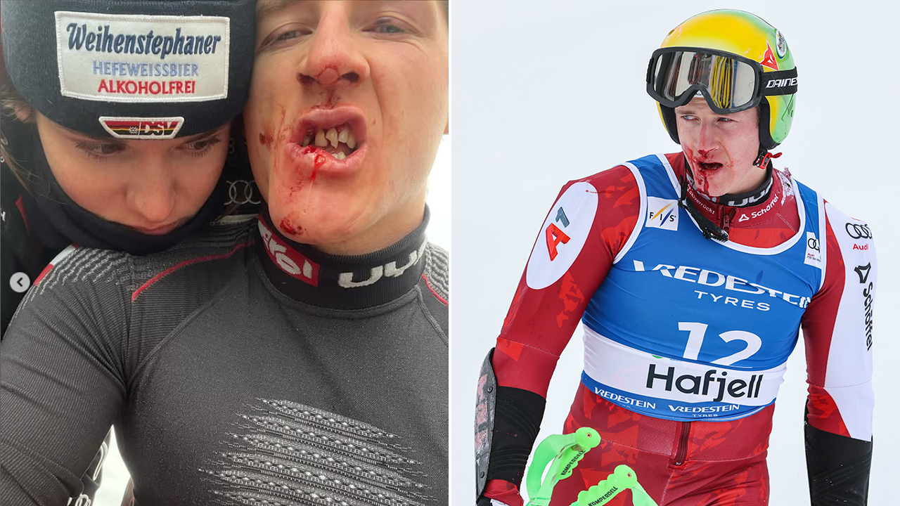 Freundin zeigt Bild von Haasers ausgeschlagenen Zähnen