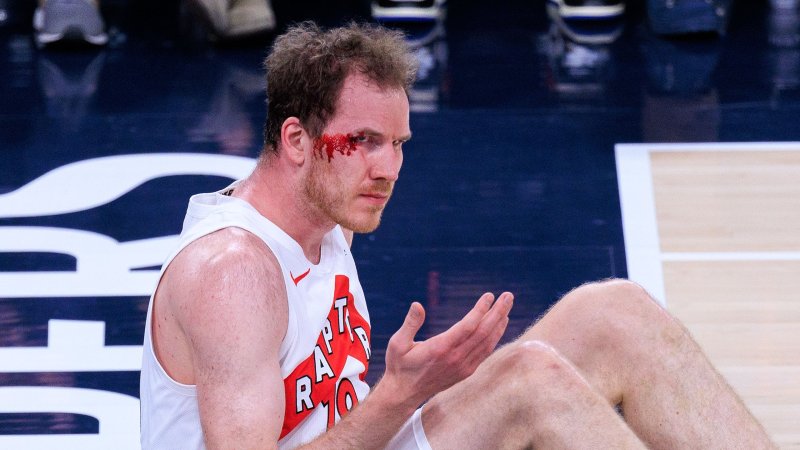 Blutend vom Feld! Pöltl mit schmerzhaftem Cut bei Raptors-Pleite