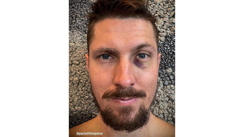 <a href='/de/daten/news/marcel-hirscher/' class='tag'>Marcel Hirscher</a> holt sich blaues Auge