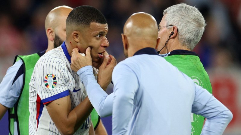 Franzosen glauben an schnelles Mbappe-Comeback