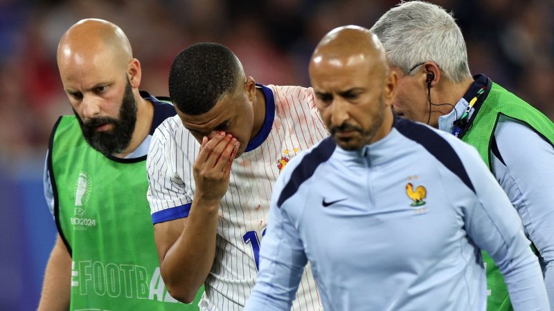 Wegen Bruch: Nasen-OP für Frankreich-Star Mbappe