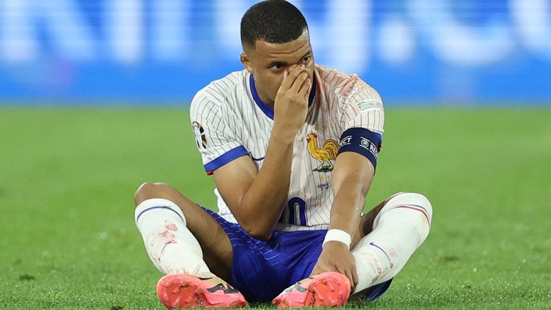 "Nase der Nation": Diagnose bei Mbappe bestätigt