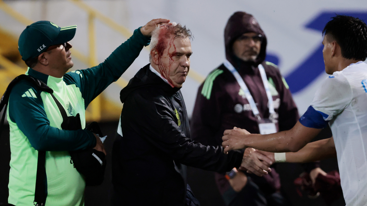 Mexiko-Trainer wird Opfer von Bierdosen-Wurf